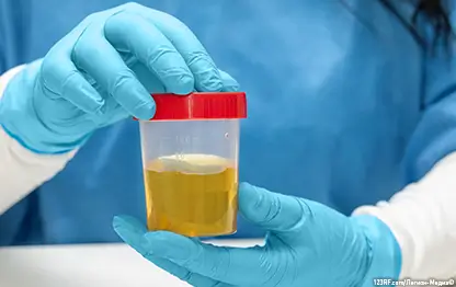 Кровь в моче у собаки